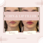 Beige Minimalist Skincare Before and After Instagram Post